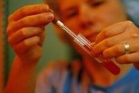 没有结婚证去厦门安宝医院做试管的成功率高吗？如何才能提升三代试管成功率