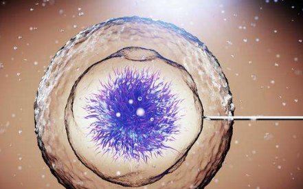 贵阳哪家医院做试管婴儿技术好？需要注意哪些问题？